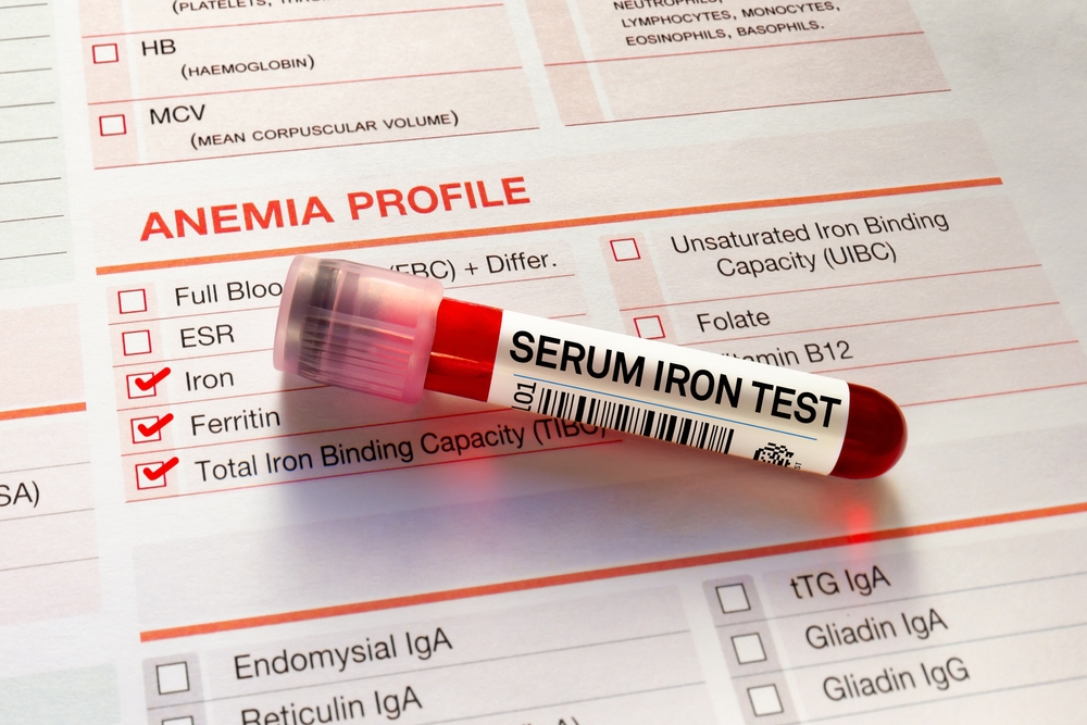 Blood,Tube,Test,With,Requisition,Form,For,Anaemia,Test.,Blood