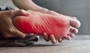 Foot Numbness | Symptoms, Causes, and Treatments